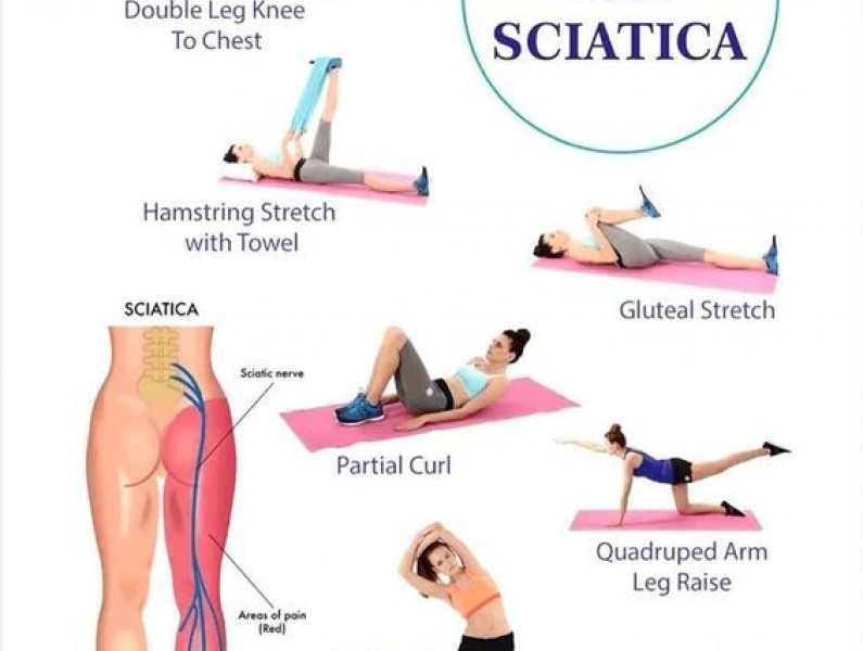 sciatica