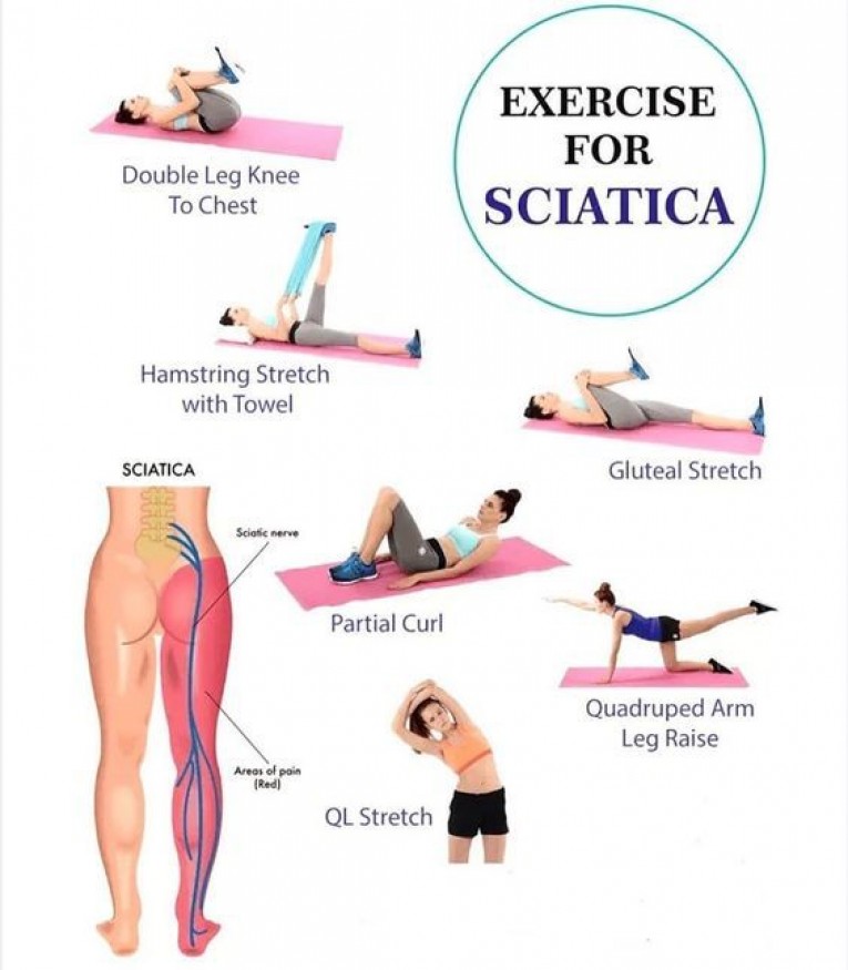 Sciatica Merivale Osteopathy Christchurch